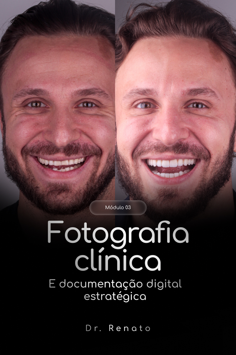 Módulo 03